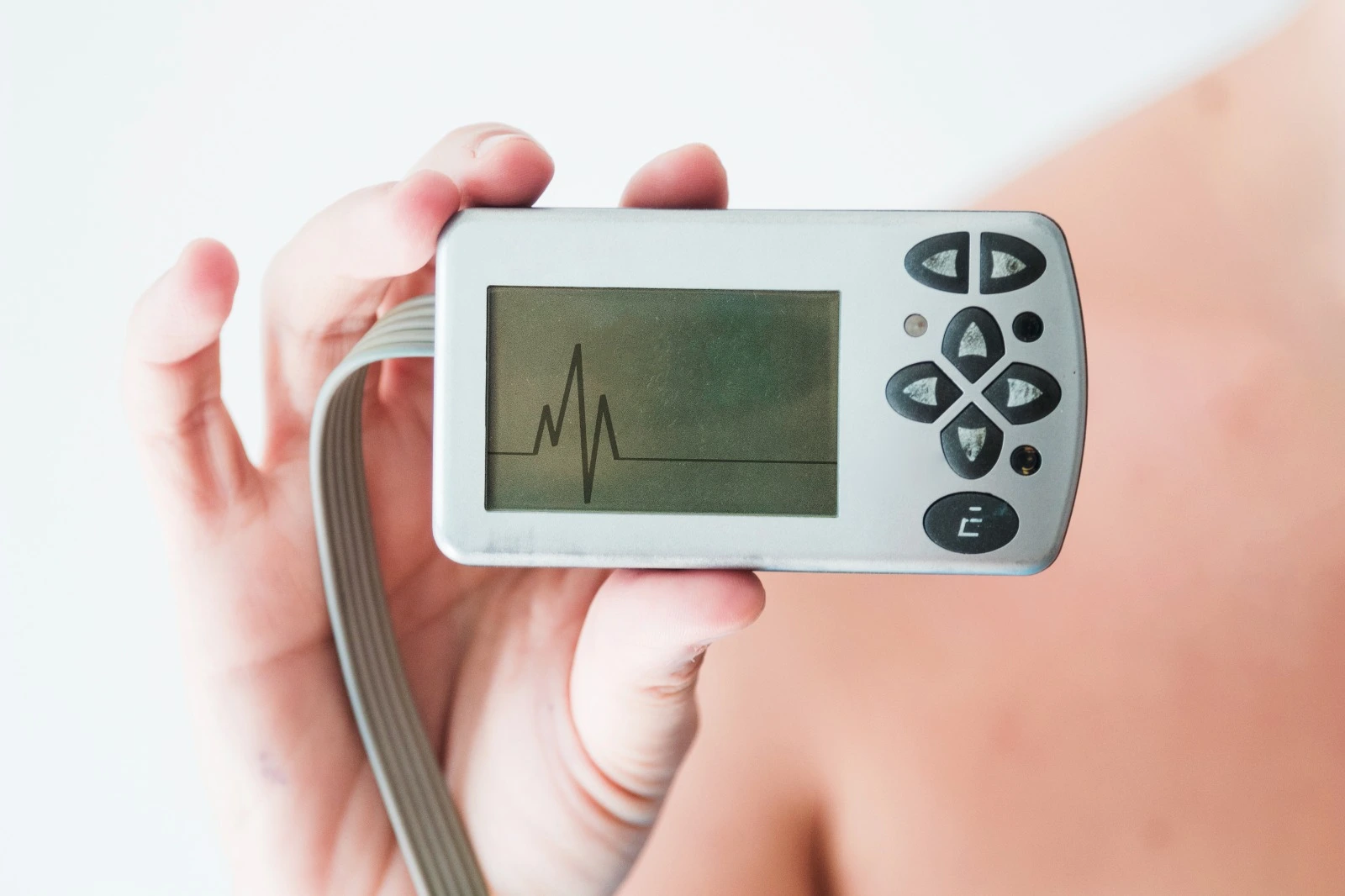 Holter Monitoring: Cara Akurat Deteksi Detak Jantung Tidak Beraturan
