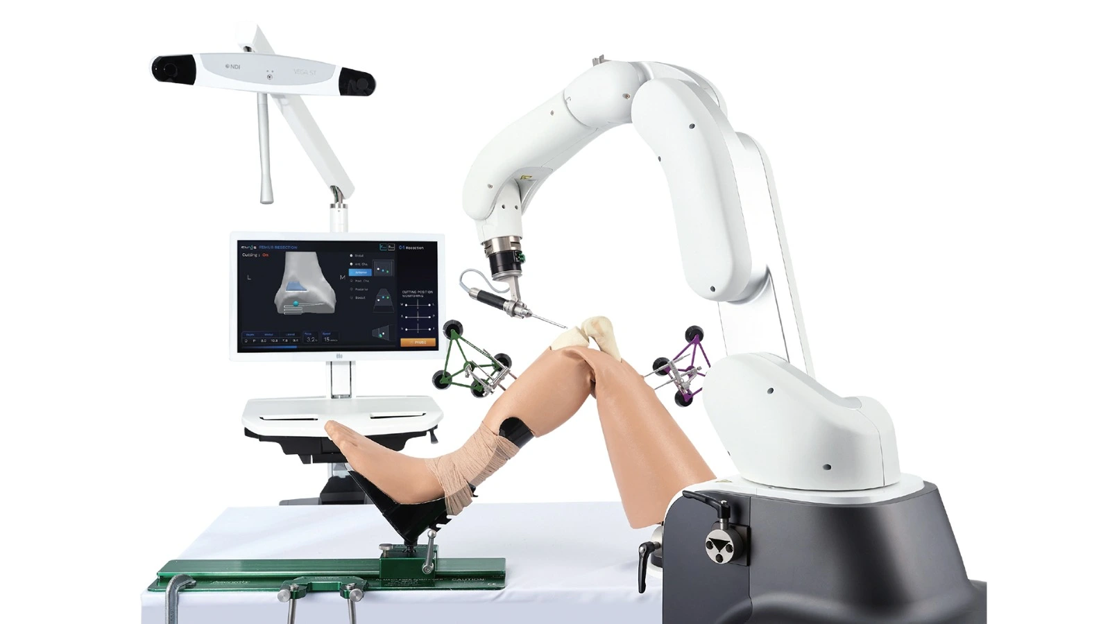 Total Knee Replacement: Solusi Lutut Nyeri Saat Berkegiatan