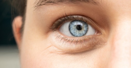Blepharoplasty Adalah Operasi Kelopak Mata, Bagaimana Prosedurnya?