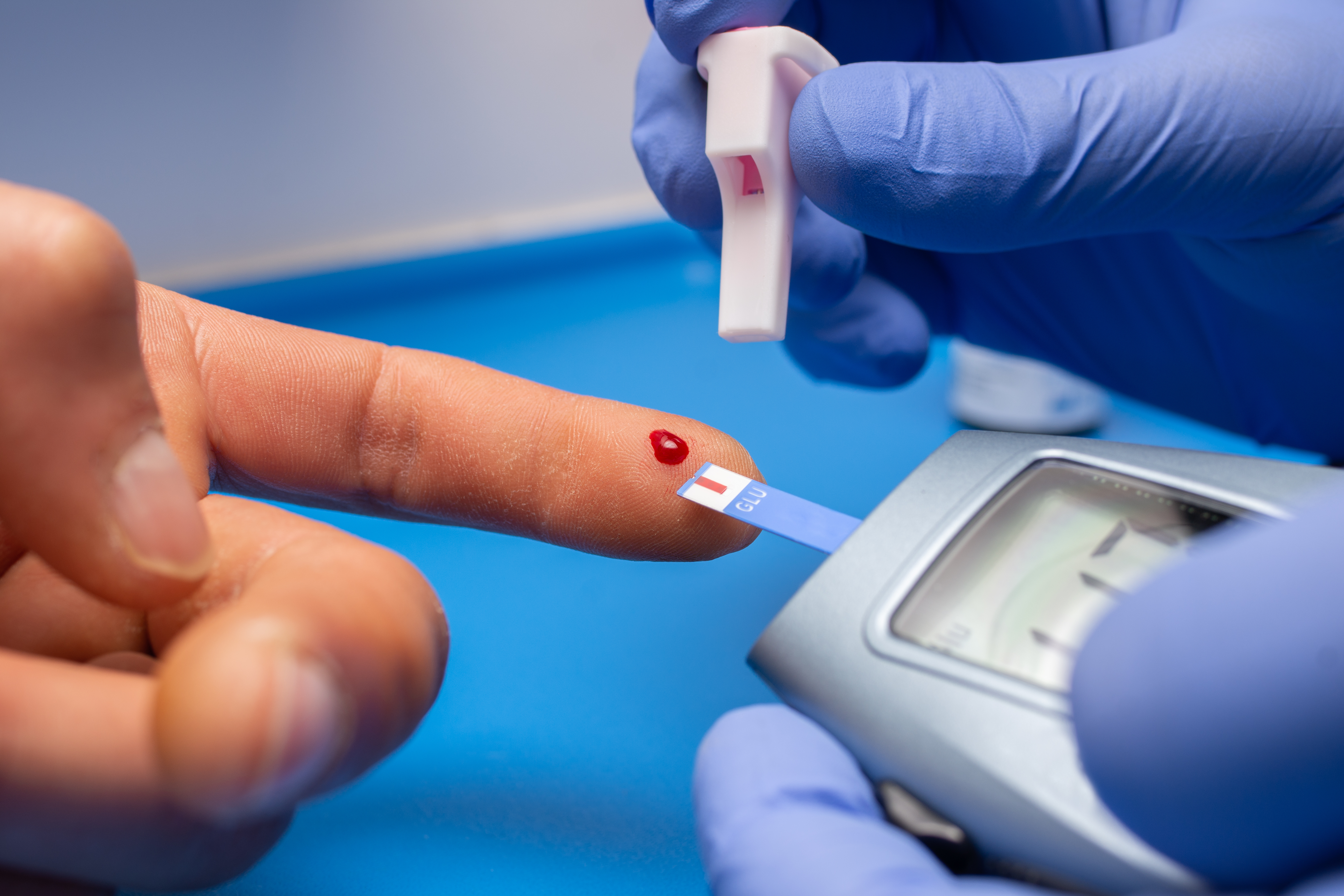 A closeup shot of a doctor with rubber gloves taking a blood test from a patient
