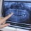 Bagaimana X-Ray Panoramic bisa Deteksi Gigi Bungsu